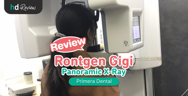 Review Rontgen Gigi Panoramic di Primera Dental