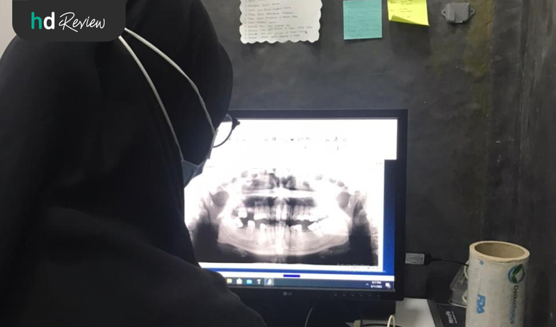 Hasil Rontgen Gigi Panoramic di Primera Dental