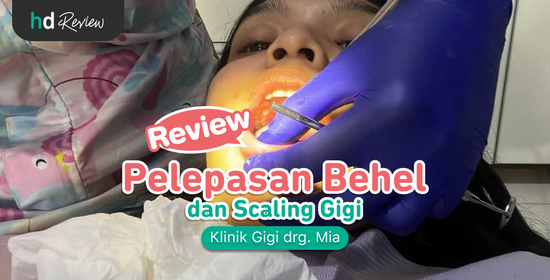 Review Pelepasan Behel di Klinik Gigi drg. Mia