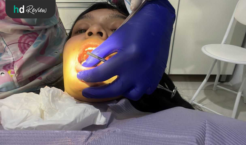 Proses Pelepasan Behel di Klinik Gigi drg. Mia