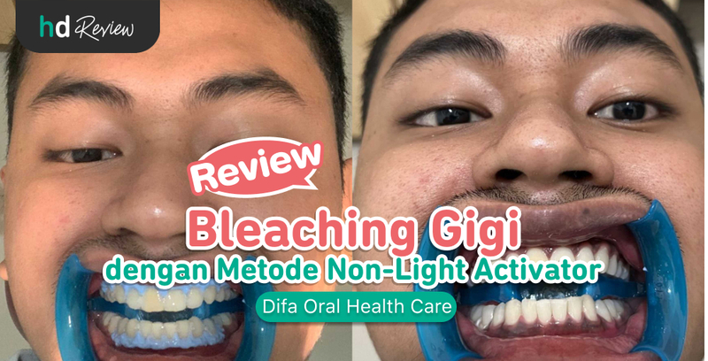 Review Bleaching Gigi di Difa Oral Health Care