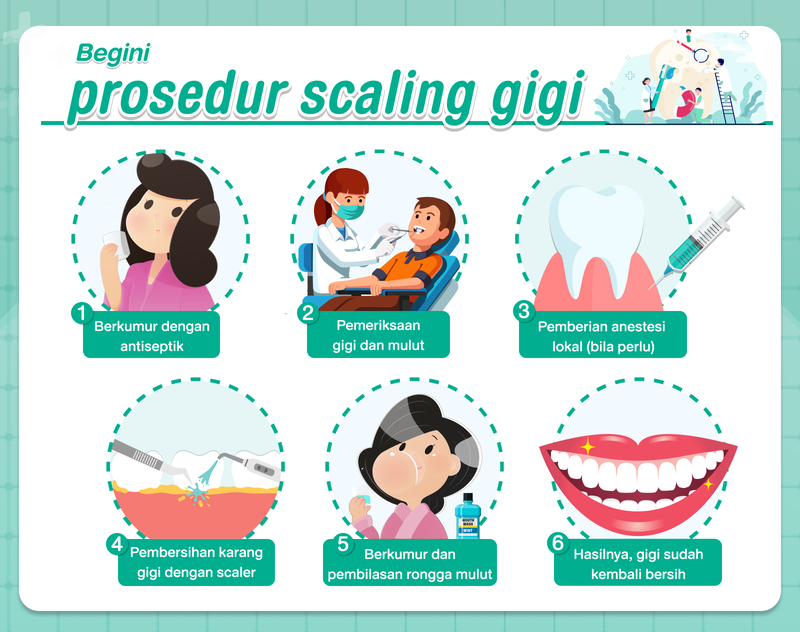 prosedur scaling gigi