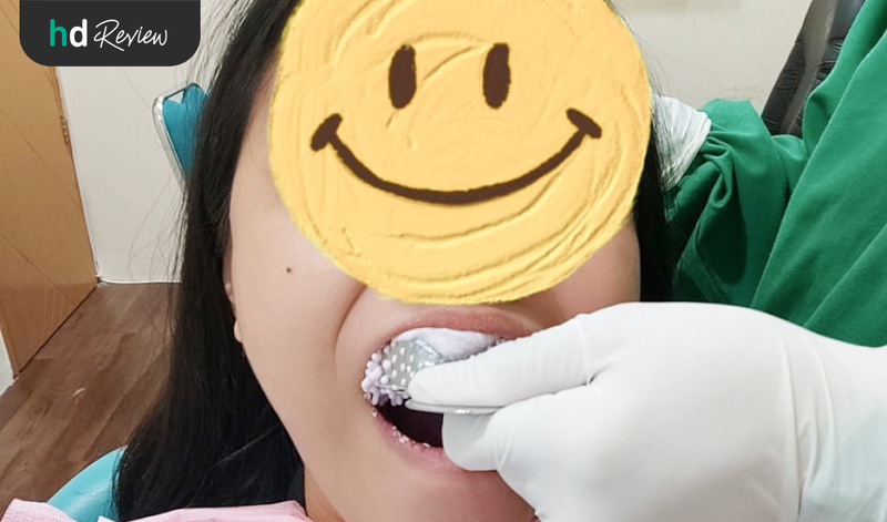 Review Pemasangan Gigi Palsu Lepasan Valplast di Klinik Tooth Signature, gigi tiruan, gigi palsu valplast