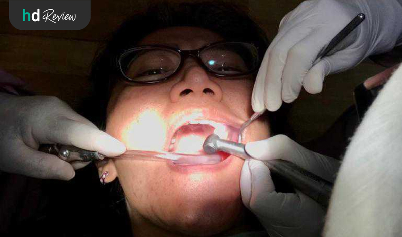 Proses Tambal Gigi di Tooth Signature