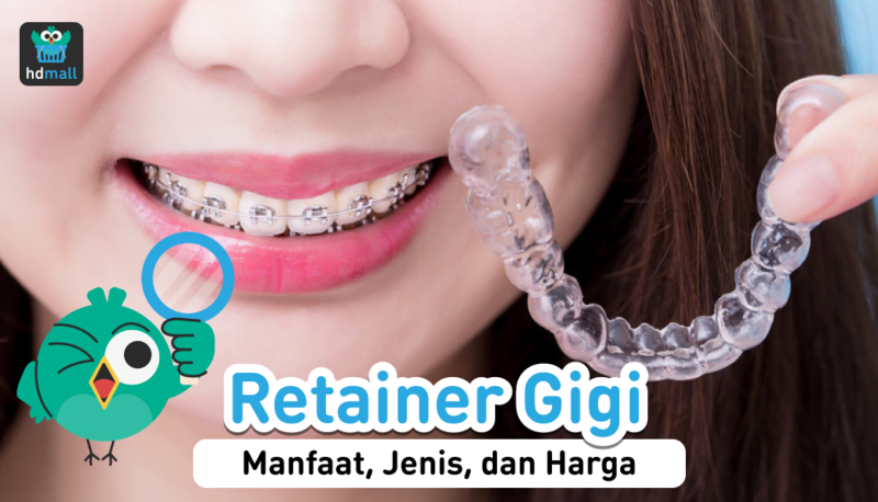 Retainer Gigi