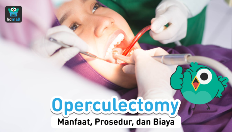 Operculectomy