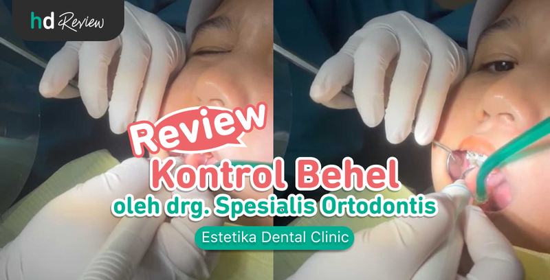 Review Kontrol Behel di Estetika Dental Clinic