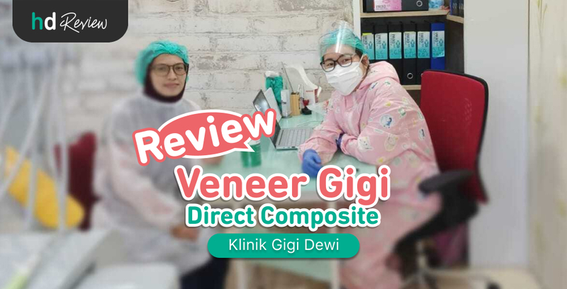 Review Veneer Gigi di Klinik Gigi Dewi, memutihkan gigi