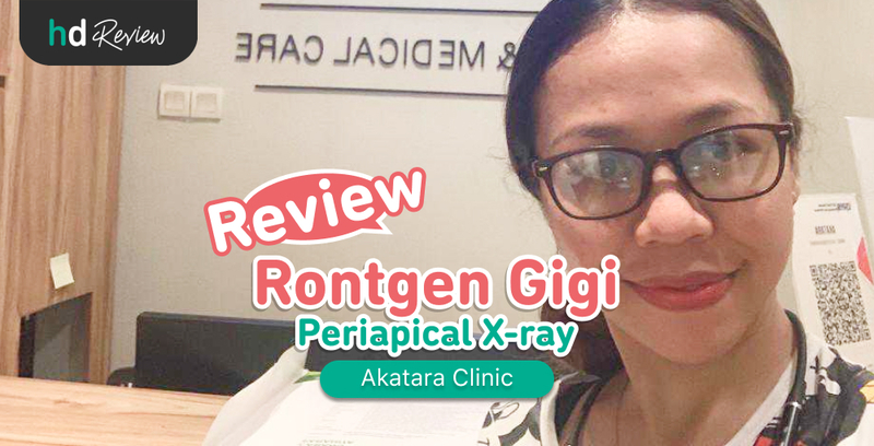 Review Rontgen Gigi Periapikal di Akatara Clinic, rontgen periapical