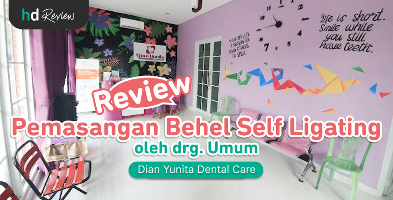 Review Pemasangan Behel Self Ligating di Dian Yunita Dental Care