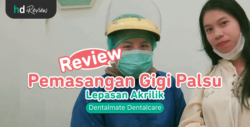 Review Gigi Palsu Lepasan Akrilik di Dentalmate Dentalcare