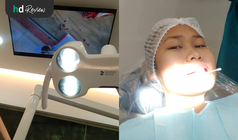 Review Cabut Gigi Bungsu di Adore Dental