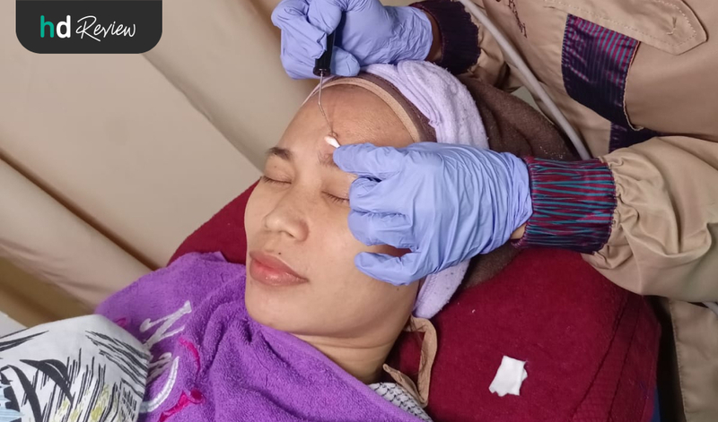 Review Elektrocauter di Nadisa Beauty Care