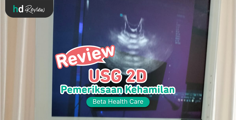 Review USG 2D di Beta Health Care
