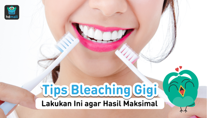 Bleaching Gigi