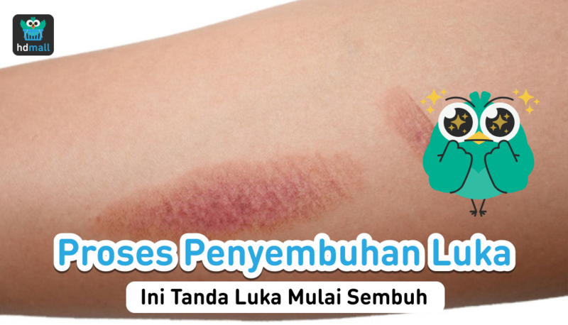 Proses Penyembuhan Luka