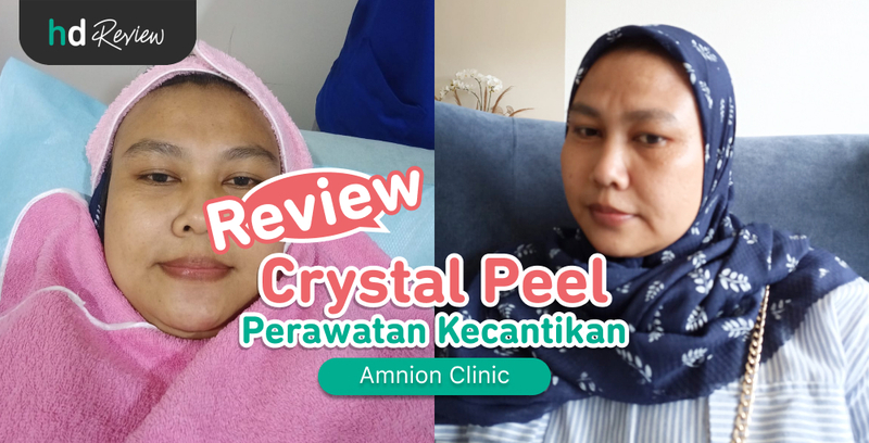 Review Crystal Peel di Amnion Clinic