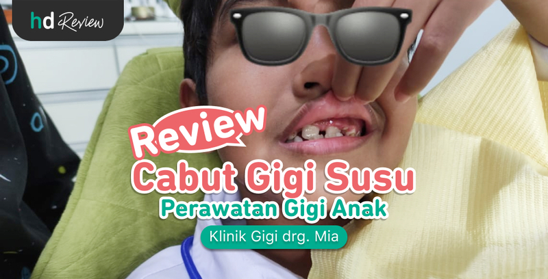 Review Cabut Gigi Susu Anak di Klinik Gigi drg. Mia