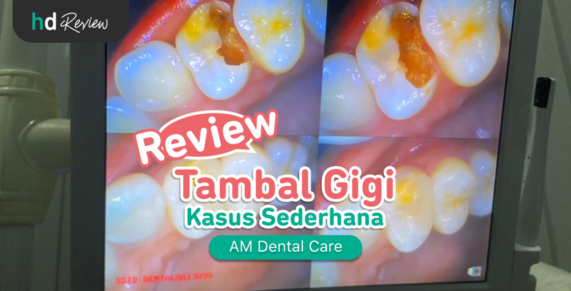 Review Tambal Gigi di AM Dental Care