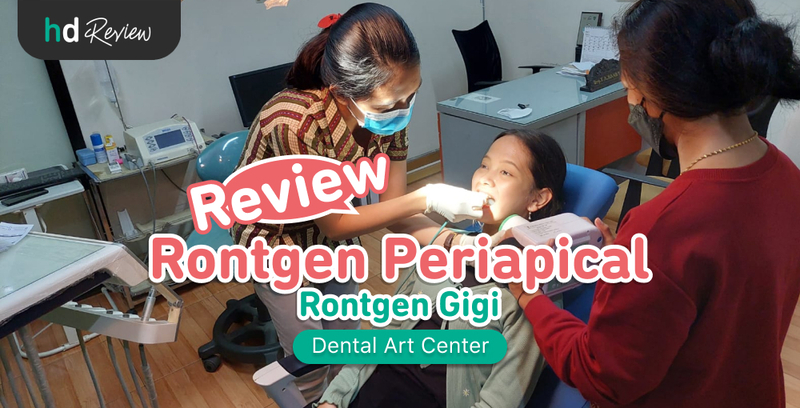 Review Rontgen Periapical di Dental Art Center, rontgen gigi, rontgen gigi periapikal, rontgen periapikal