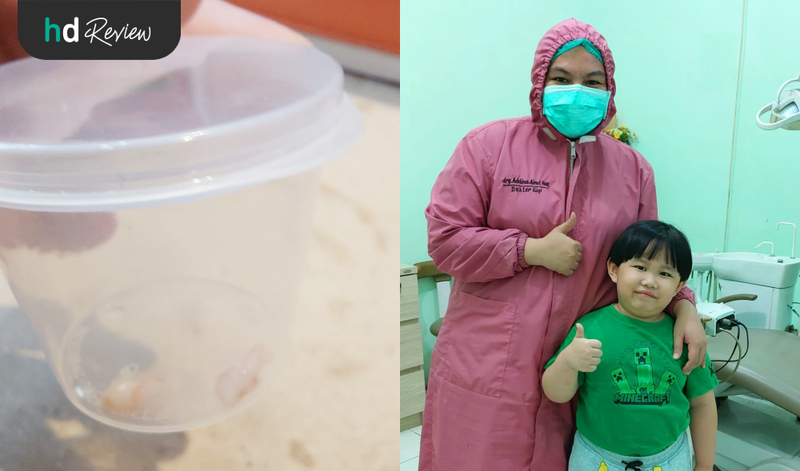 Review Cabut Gigi Anak di Prudentalcare drg. Addina Ainul Haq, cabut gigi susu anak