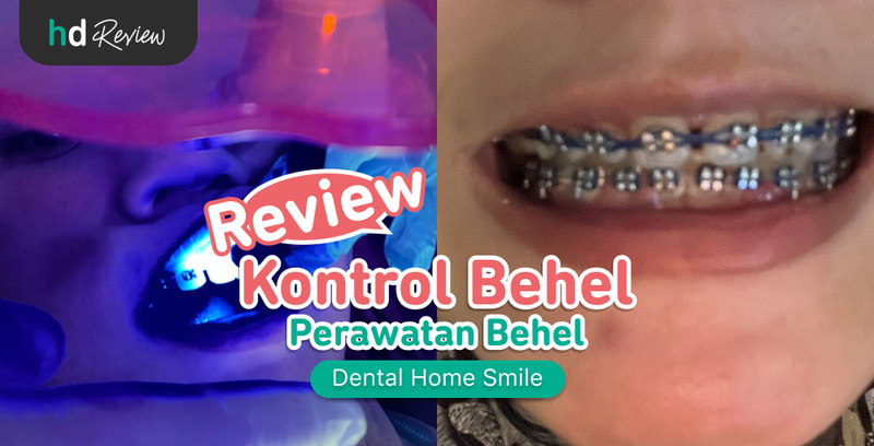 Review Kontrol Behel di Dental Home Smile, kontrol kawat gigi