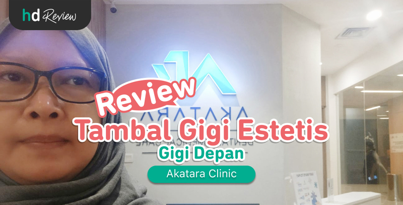 Review Tambal Gigi Estetis di Akatara Clinic, tambal gigi depan