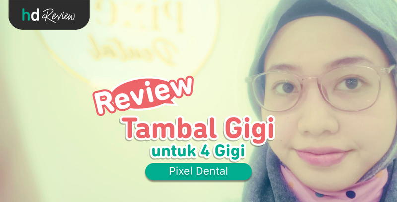 Review Tambal Gigi di Pixel Dental, gigi berlubang, tambal gigi berlubang