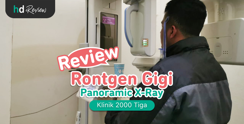 Review Rontgen Panoramic di Klinik 2000 Tiga, rontgen gigi