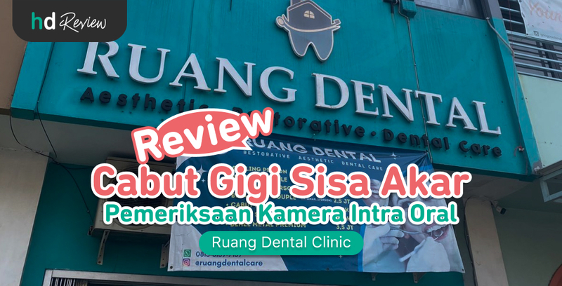 Review Cabut Gigi Sisa Akar di Ruang Dental Clinic, cabut sisa akar gigi, cabut gigi