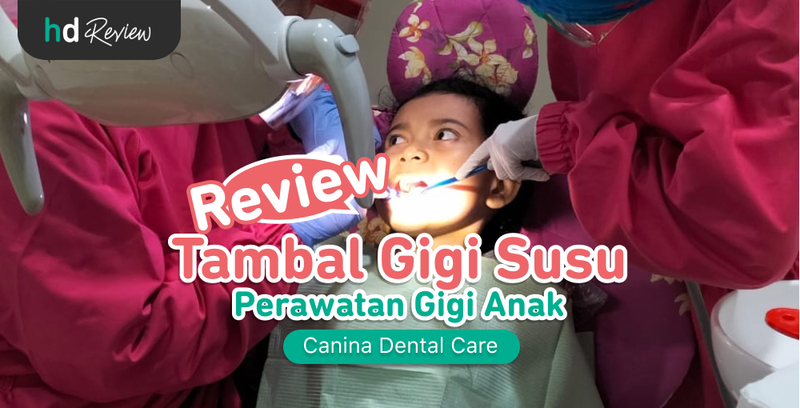 Review Tambal Gigi Susu di Canina Dental Care, tambal gigi anak, tambal gigi susu anak