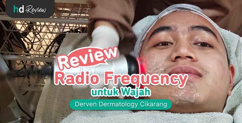 eview RF Wajah di Derven Dermatology Cikarang, radio frequency, meniruskan pipi, pipi tirus, pipi tembem, pipi chubby, mengecilkan pipi