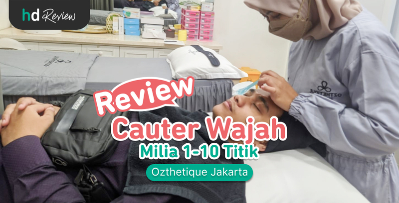 Review Cauter Milia di Ozthetique Jakarta, Milia Hilang Pede Datang!, menghilangkan milia, cauter wajah, elektrocauter