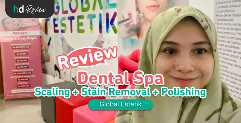 Review Dental Spa di Global Estetik, scaling gigi, pembersihan karang gigi