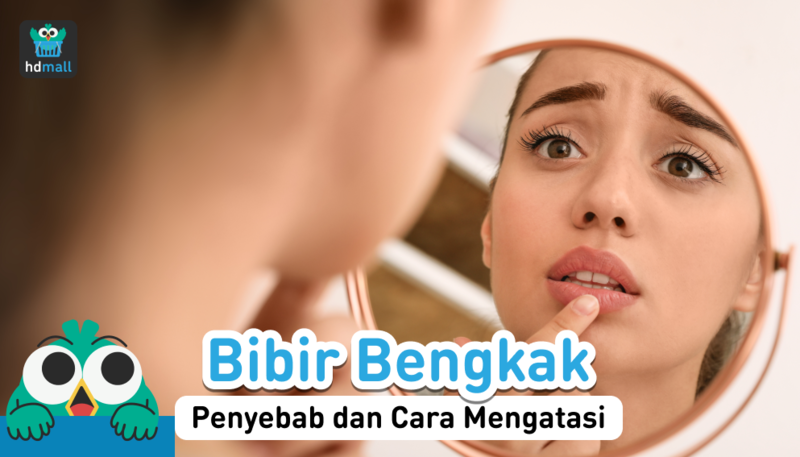 bibir bengkak, cara mengatasi bibir bengkak, pembengkakan bibir bibir bengkak, cara mengatasi bibir bengkak, pembengkakan bibir