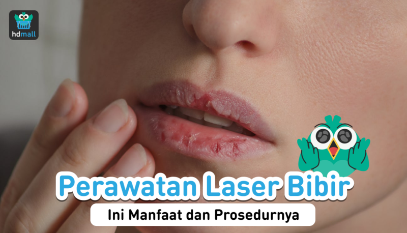 Laser Bibir