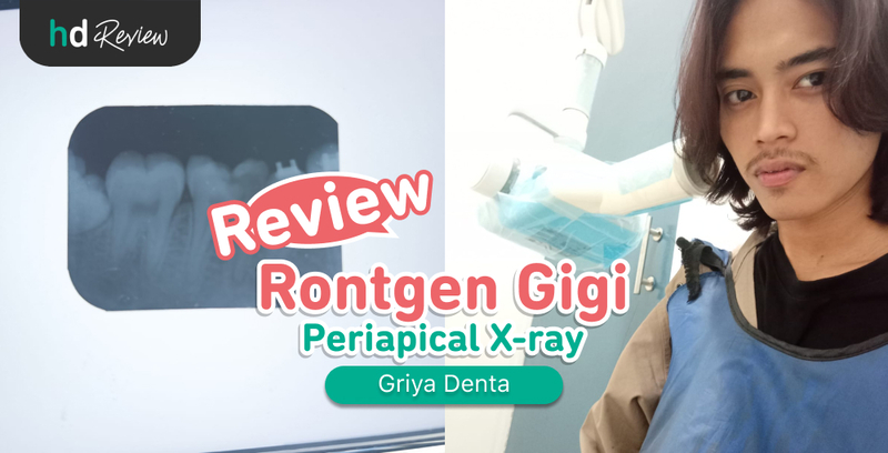 Review Rontgen Periapical di Griya Denta, Bantu Perjelas Masalah Gigi Berlubang, rontgen periapikal, rontgen gigi, jenis rontgen gigi