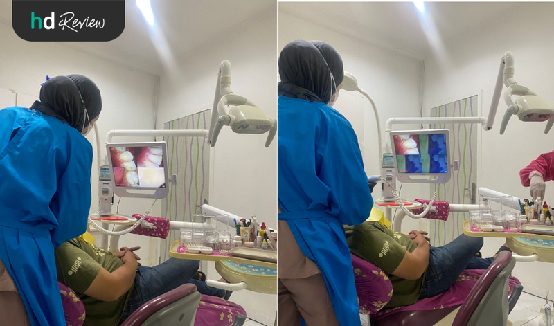 Review Tambal Gigi Belakang Estetis di Canina Dental Care, tambal gigi, penambalan gigi, gigi berlubang, scaling gigi, pembersihan karang gigi