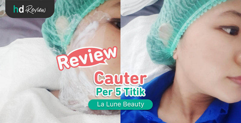 Review Cauter 5 Titik di La Lune Beauty, skin tag, perawatan cauter wajah