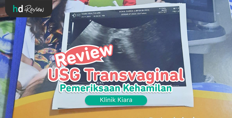 Review USG Transvaginal di Klinik Kiara, pemeriksaan kehamilan, usg kehamilan