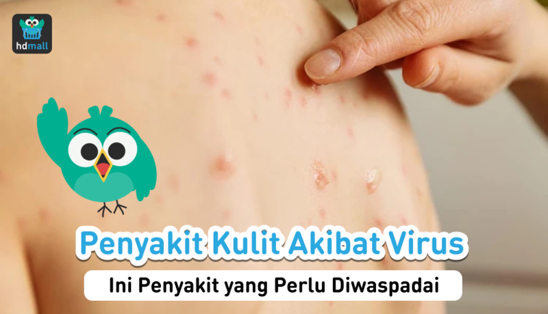 Penyakit Kulit Akibat Virus