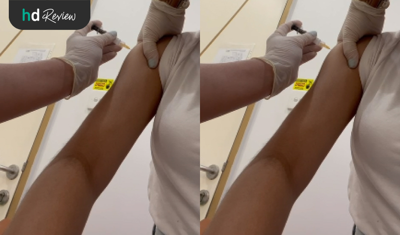Review Vaksin HPV Gardasil 3 Dosis di Tirta Medical Center, vaksinasi HPV, kanker serviks, kutil kelamin, infeksi HPV