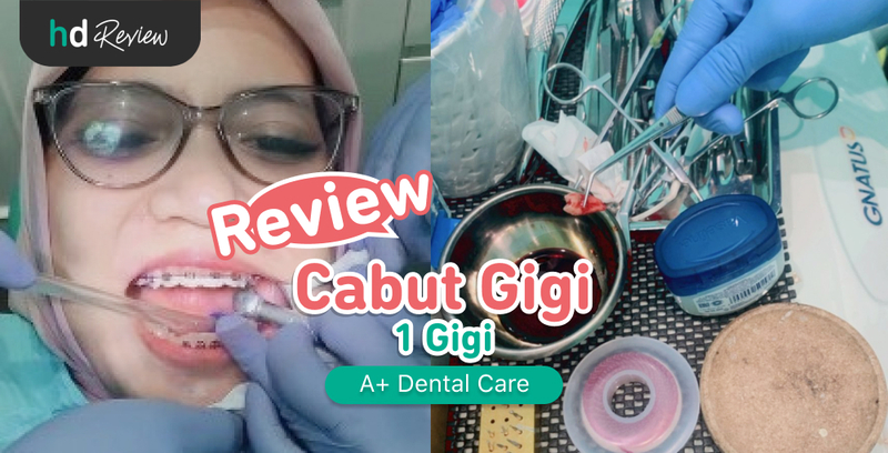 Review Cabut Gigi di A+ Dental Care, Optimalkan Gigi Rapi saat Pakai Behel