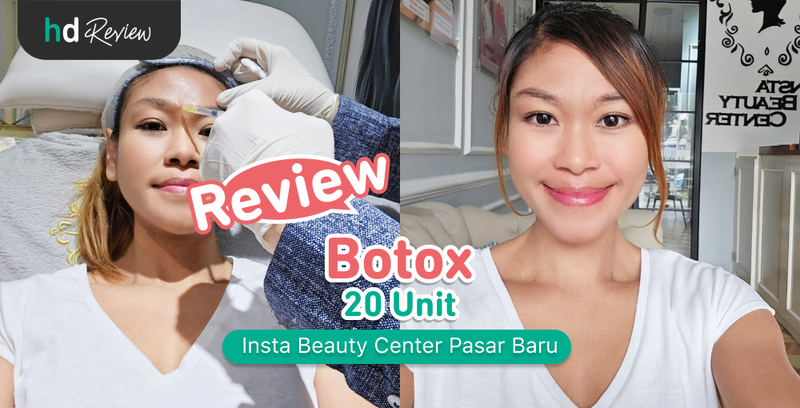 Review Botox 20 Unit di Insta Beauty Center, Kulit Kencang Bebas Kerutan dalam 3 Hari!, suntik botox, botox wajah, menghilangkan keriput