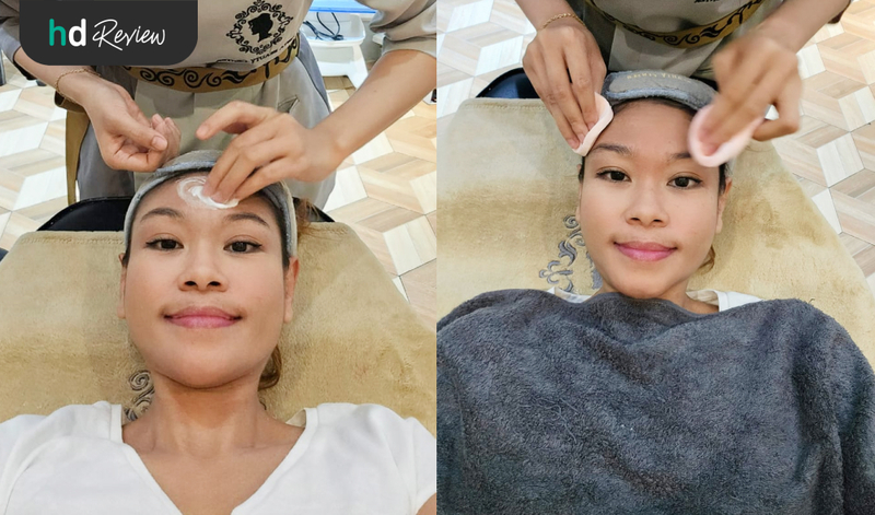 Review Botox 20 Unit di Insta Beauty Center, Kulit Kencang Bebas Kerutan dalam 3 Hari!, suntik botox, botox wajah, menghilangkan keriput