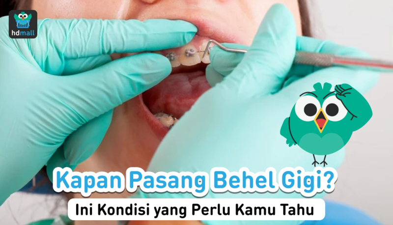 pasang behel gigi