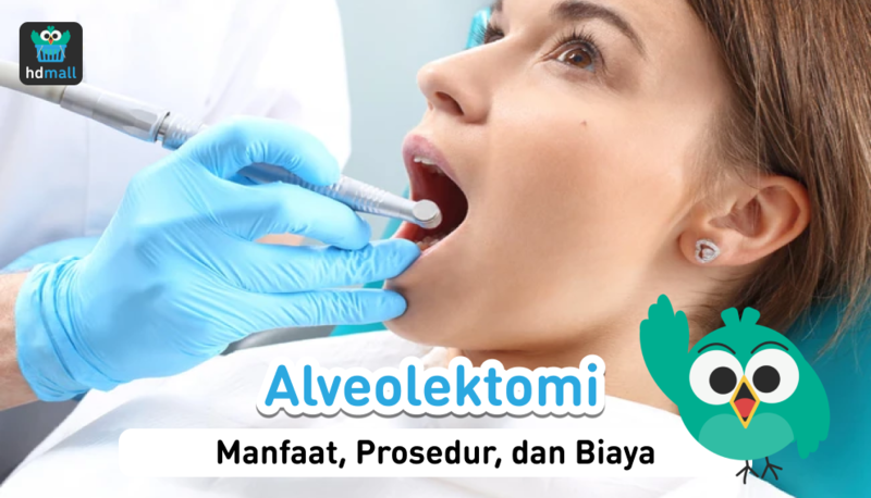 Alveolektomi