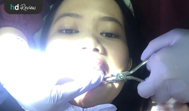 Proses pelepasan behel di Umma Dental Care