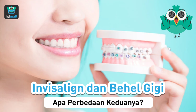 Invisalign 