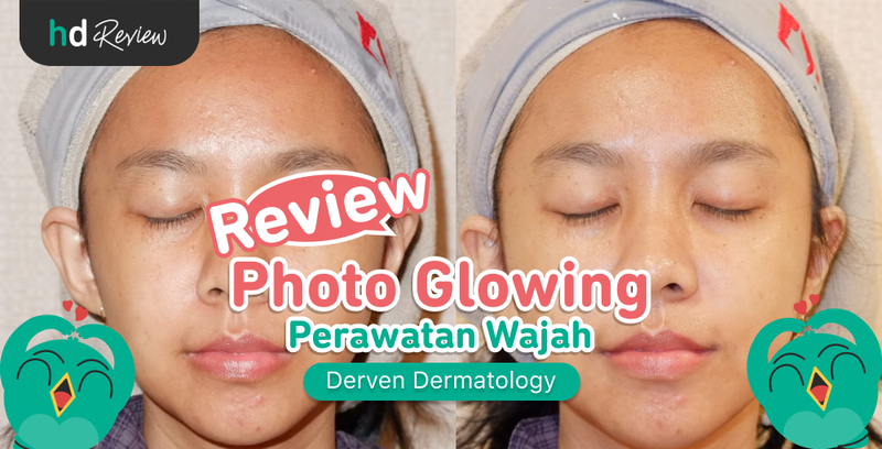 Review Photo Glowing di Derven Dermatology, Wajah Lebih Cerah dari Bekas Jerawat Hitam, perawatan mencerahkan wajah, facial glowing